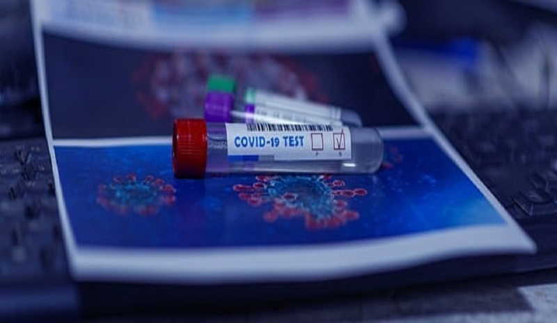 Barracuda Researchers identify a spike in COVID 19 test-related email scams with the rise in Omicron cases