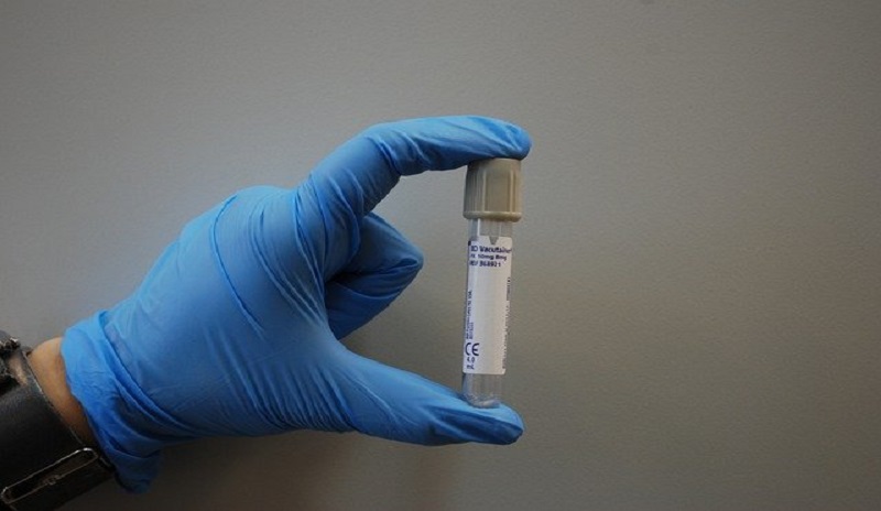 KRSNAA leverages AI to deliver quality diagnostics to the rural hinterlands of India 